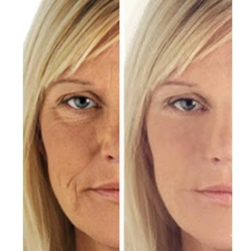 Hyperion Biotic Repair Eye Treatment