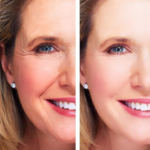 Hyperion Biotic Repair Eye Treatment