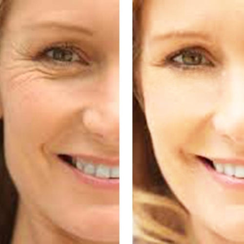 C+ Antioxidant Wrinkle Reduction Serum