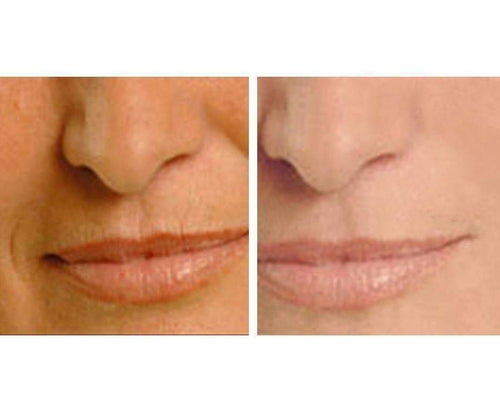 Hyperion Biotic Repair Eye Treatment